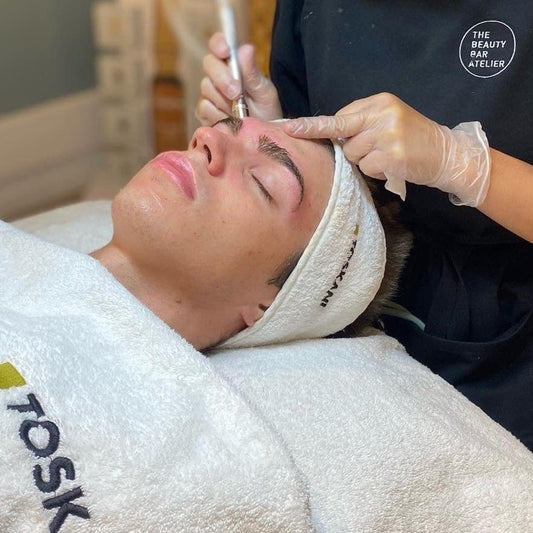 Limpieza facial punta diamante