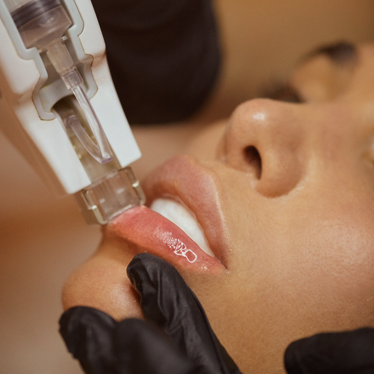 Toskani hydrakiss hyaluronic