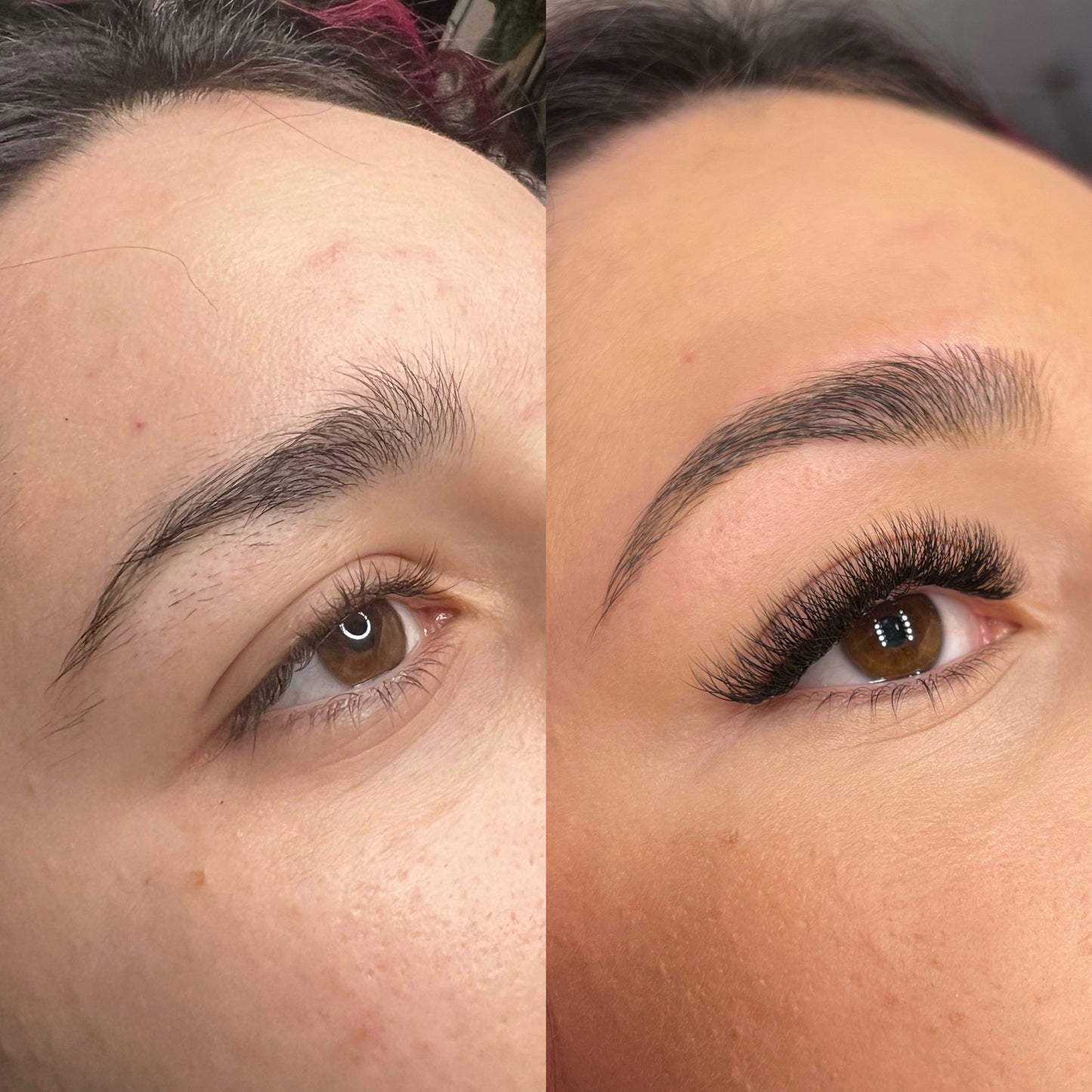 Relleno volumen mixto (cada 3 semanas)